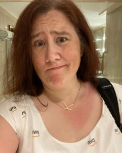 The AWS dress definitely sets off the sunburn nicely… 😬 #awscommunityapac